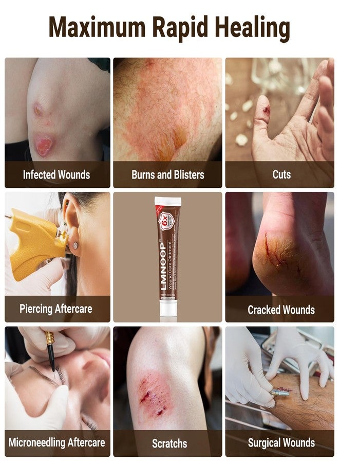 لمنوب كريم LMNOOP® للعناية بالجروح، مرهم لشفاء البشرة وإصلاحها لعلاج العدوى والقروح والجروح والخدوش والحروق ولدغات الحشرات والجروح الجراحية ومختلف أنواع الجروح، منتجات لعلاج الضغط وكريم قرح الفراش - Image 3